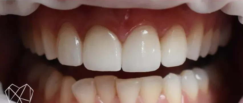 Patient smile after dental treatment